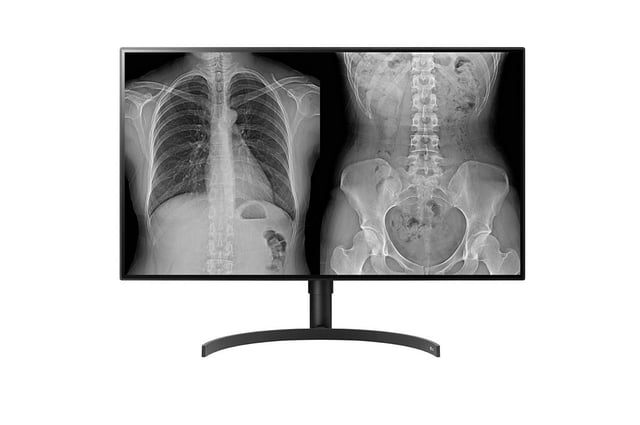 LG 32HL512D-M computer monitor 80 cm (31.5") 3840 x 2160 Pixels Full HD Zwart